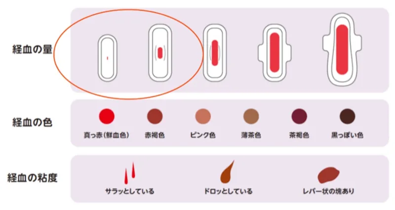 経血の量・色・粘度の目安。ジエノゲスト服用中の出血量は最も少ない左側の程度