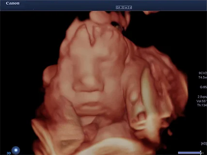 4D超音波検査で見たお腹の中の赤ちゃんの様子