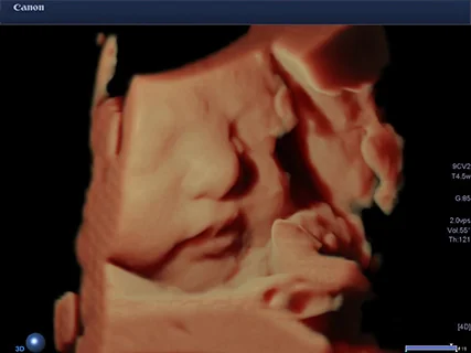 4D超音波検査で見たお腹の中の赤ちゃんの様子