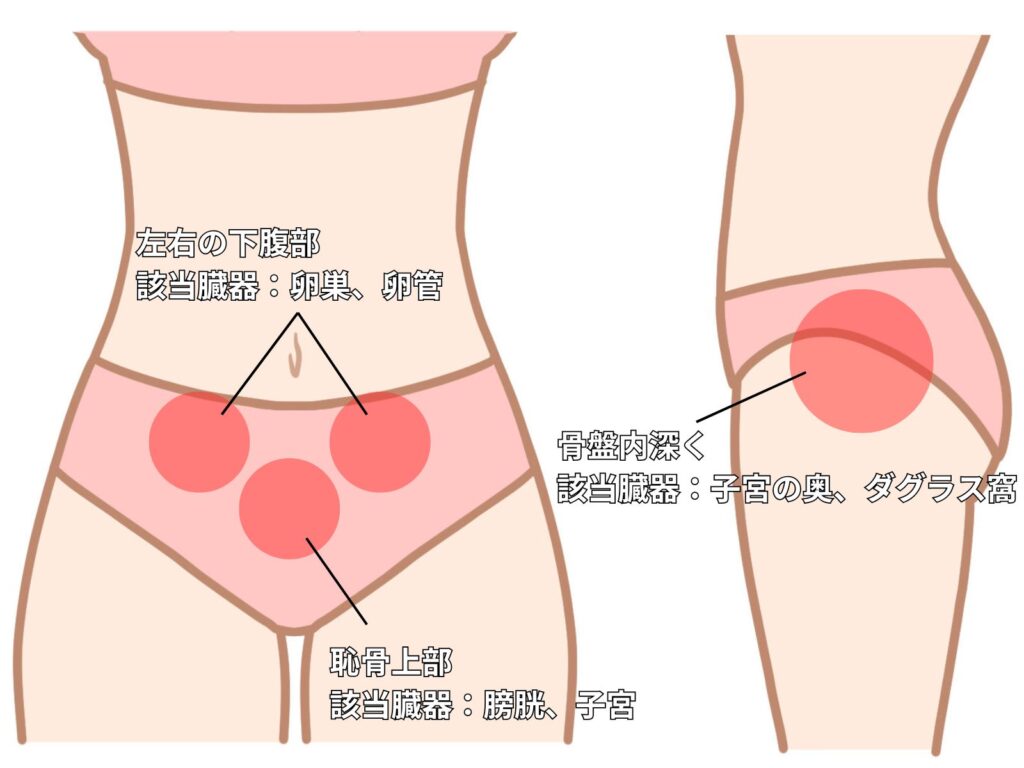 性行為後 下腹部 痛い